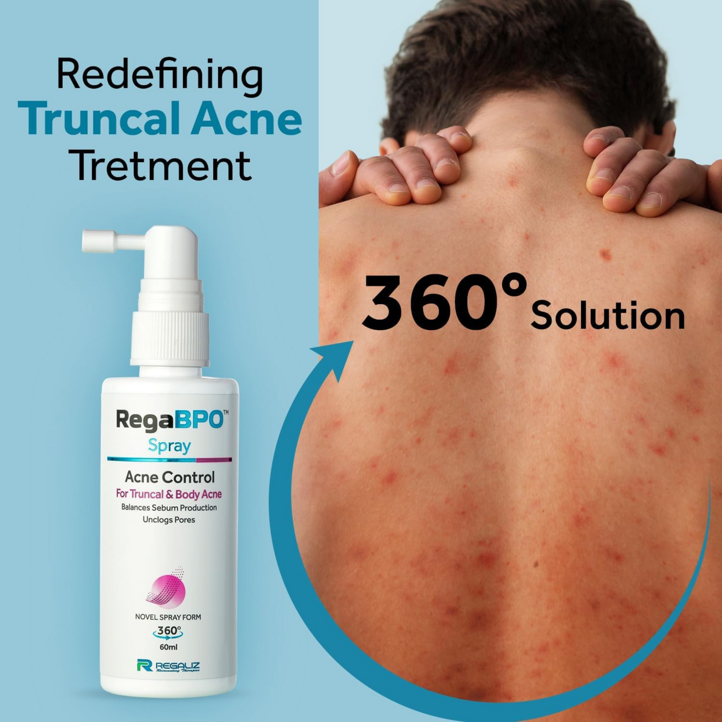 Rega-BPO Acne Control Body Spray | 2x60 ml