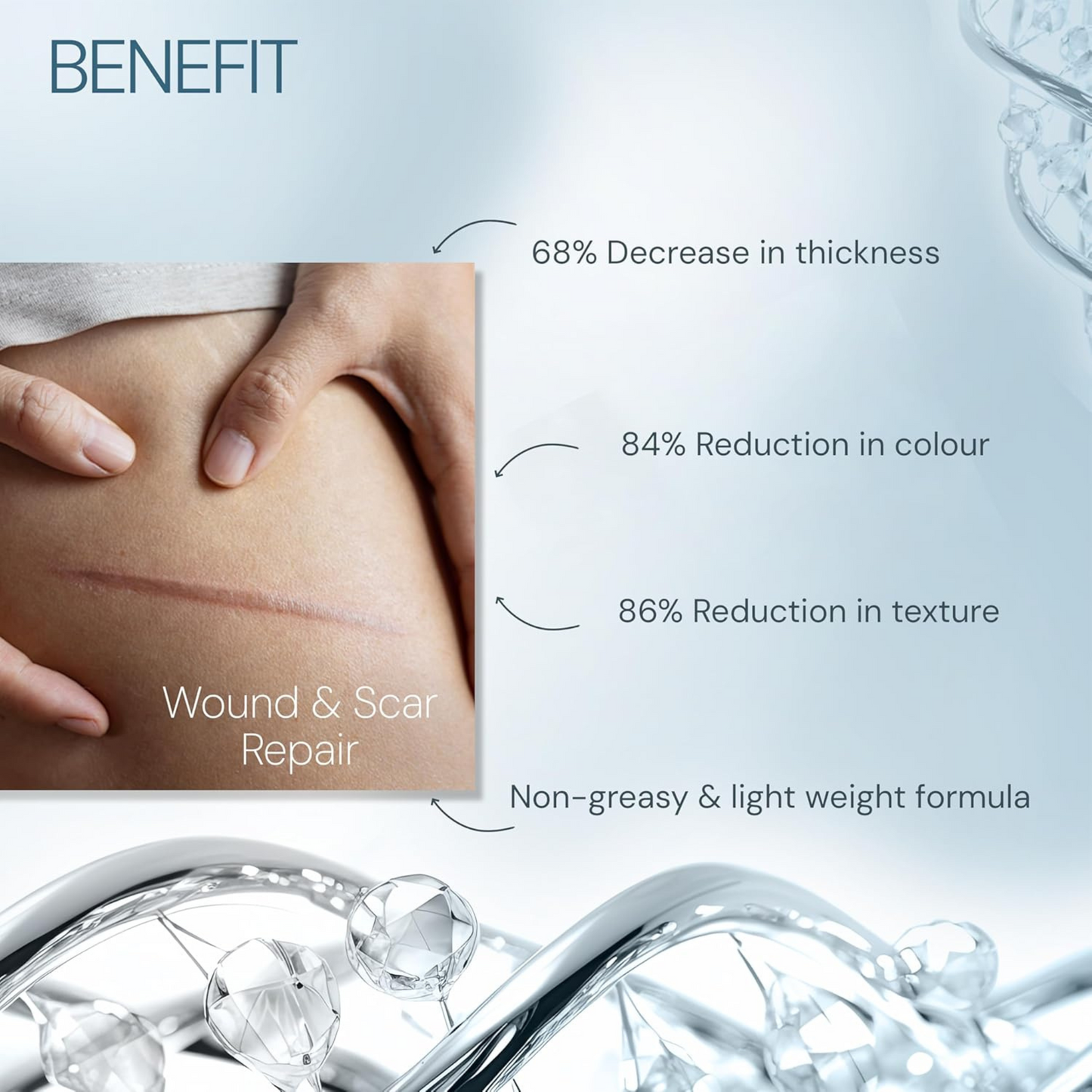 Vitaderm C-Scar Gel