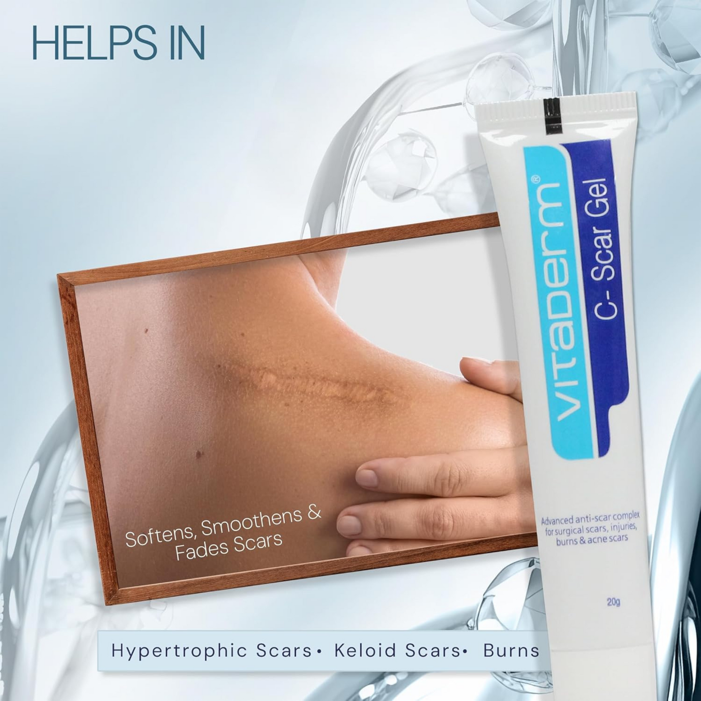 Vitaderm C-Scar Gel